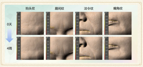 QQ20250120-161832.png
